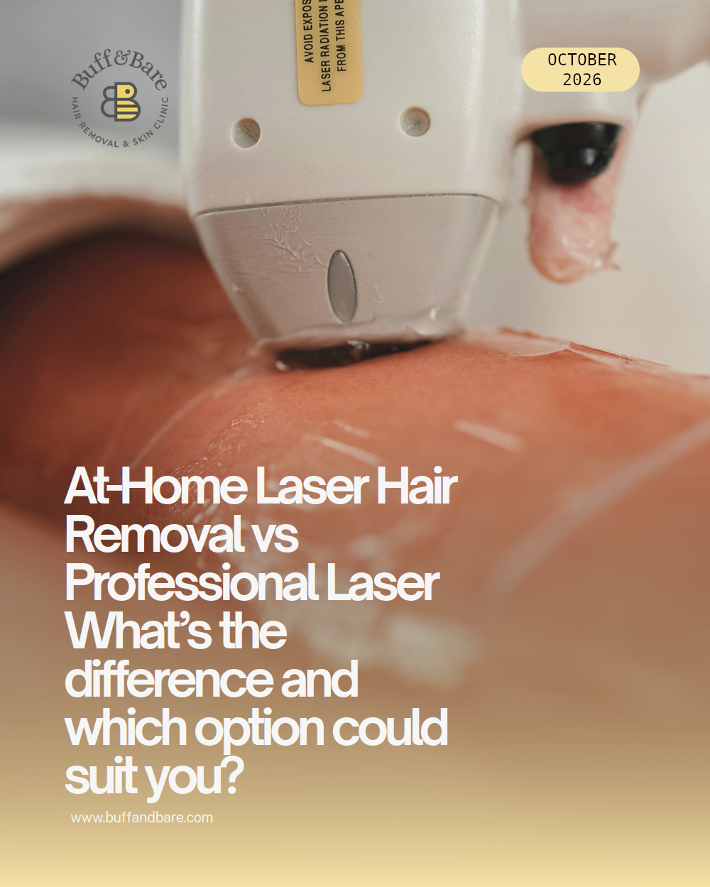At-Home Laser Hair Removal vs Professional Laser: what’s the difference and which option could suit you? Buff and Bare